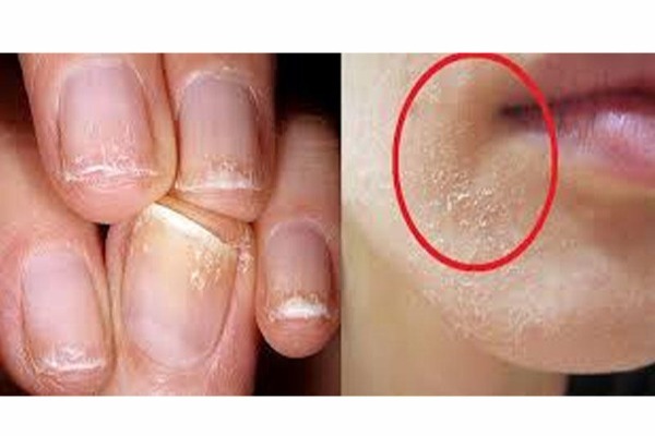 Xərçəngə yol açan “sakit epidemiya” – Hər kəs bu muayinədən keçməlidir
