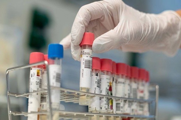 Çinli həkim koronavirusun bitəcəyi tarixi açıqladı -       ŞAD XƏBƏR