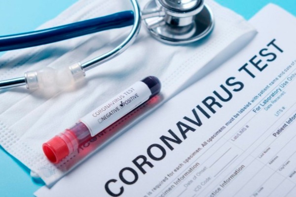 Günün yoluxma və ölüm statistikası -            Koronavirus